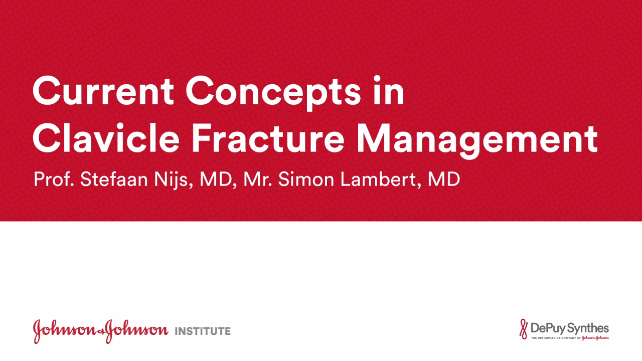 An image from the "Current Concepts in Clavicle Fracture Management with Prof Stefaan Nijs, MD & Mr Simon Lambert, MD" video on the JnJInstitute.com website.