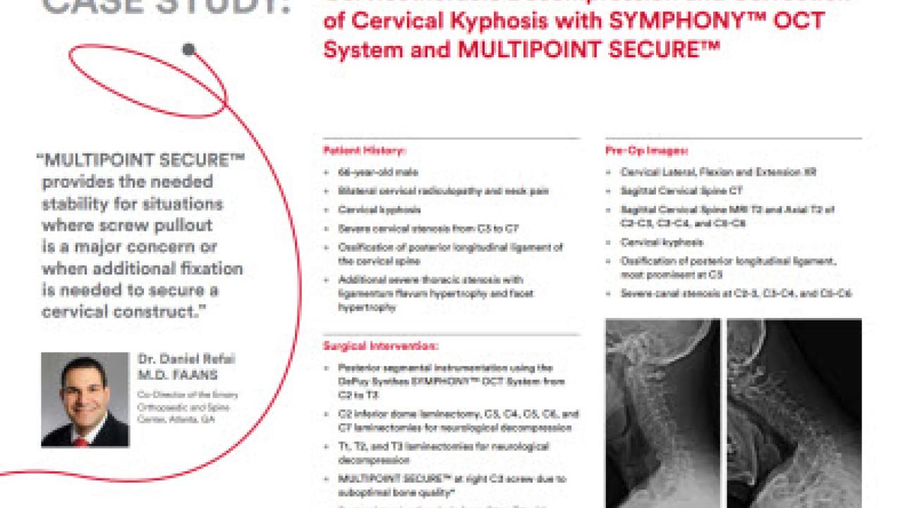 An image from the "Cervicothoracic Decompression & Correction of Cervical Kyphosis with SYMPHONY™ OCT System & MULTIPOINT SECURE™ with Daniel Refai, MD" PDF on the JnJInstitute.com website.