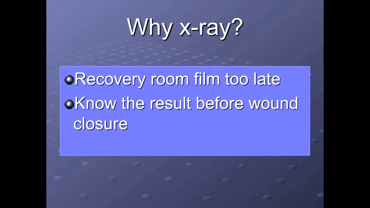 An image from the "Anterior Approach: Why X-ray with Joel Matta, MD" video on the JnJInstitute.com website.