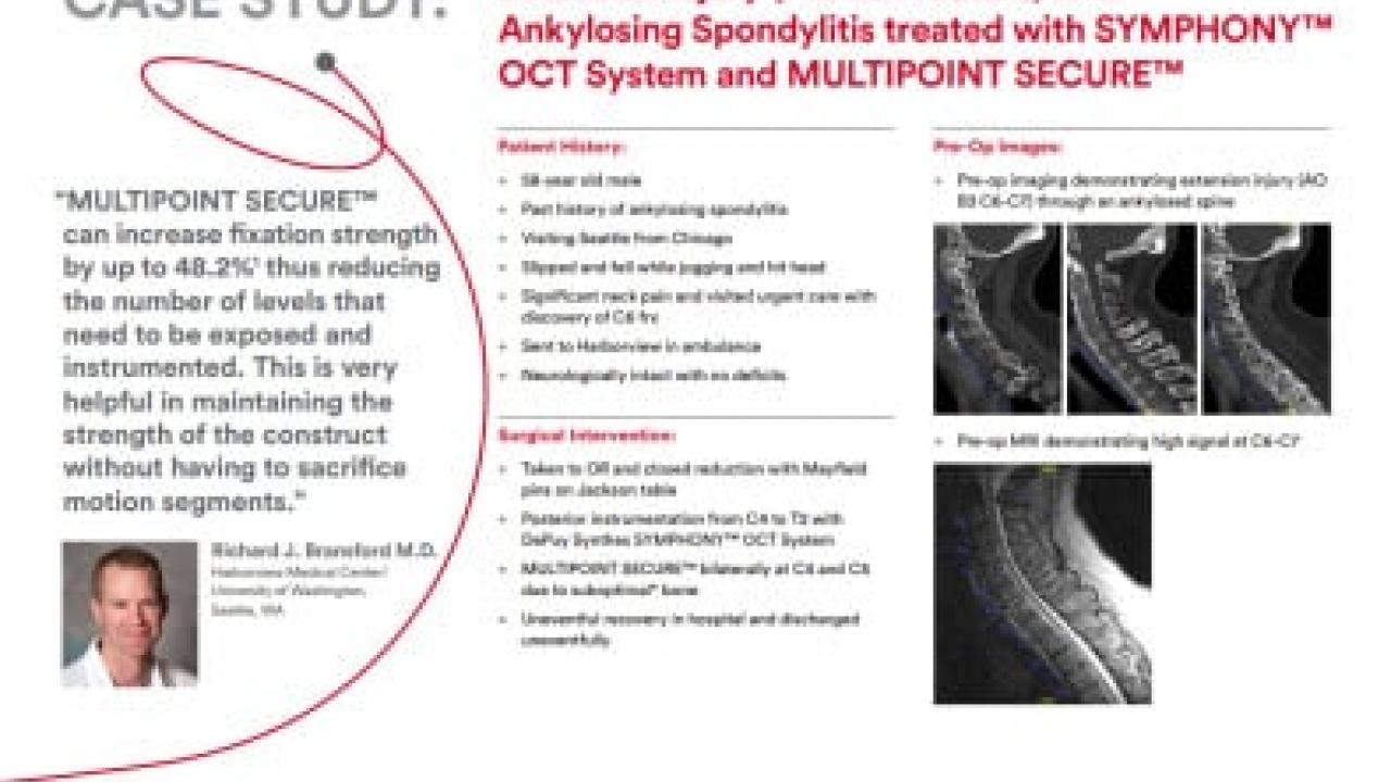 An image from the "Case Study: Extension Injury (AO B3 Fracture) with Ankylosing Spondylitis treated with SYMPHONY™ OCT System & MULTIPOINT SECURE™ with Richard Bransford, MD" PDF on the JnJInstitute.com website.
