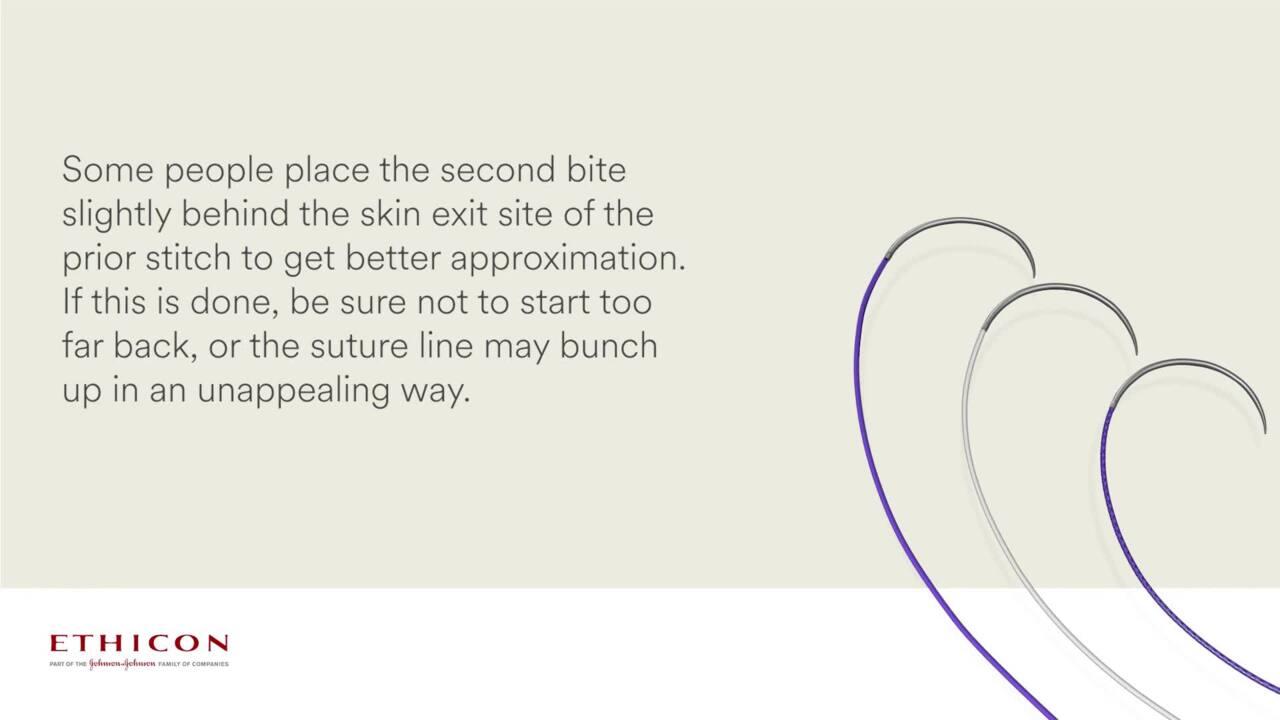 image of "Subcuticular Suture Technique" video on jnjinstitute.com