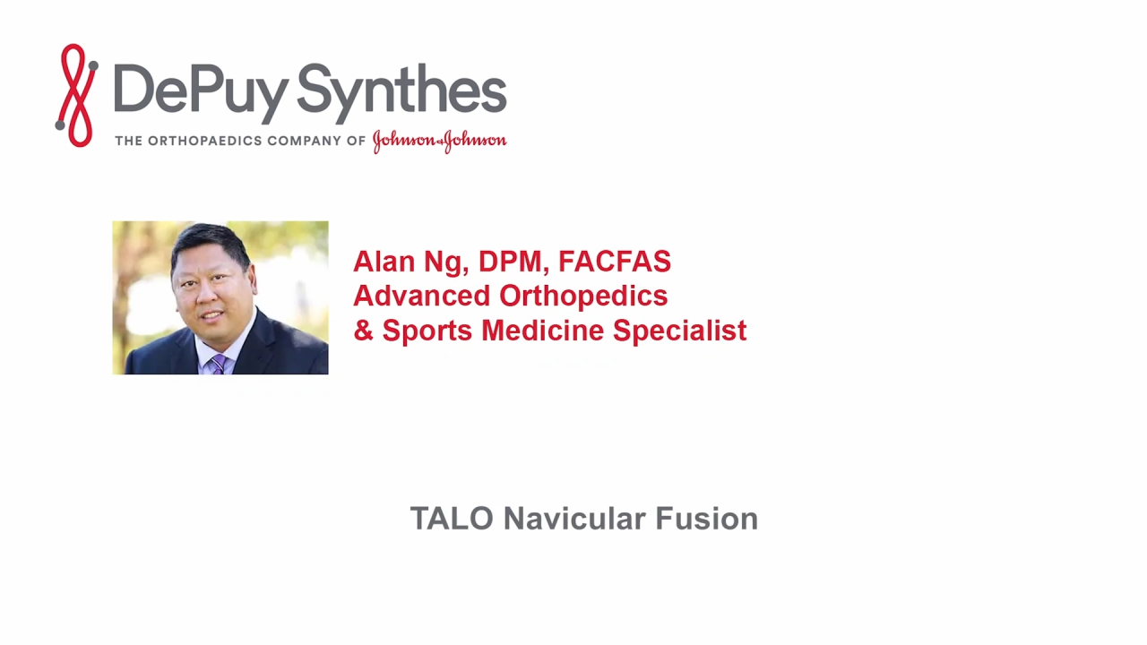 An image from the "Dorsal Approach Talonavicular Joint Arthrodesis with Alan Ng, DPM" video on the JnJInstitute.com website.