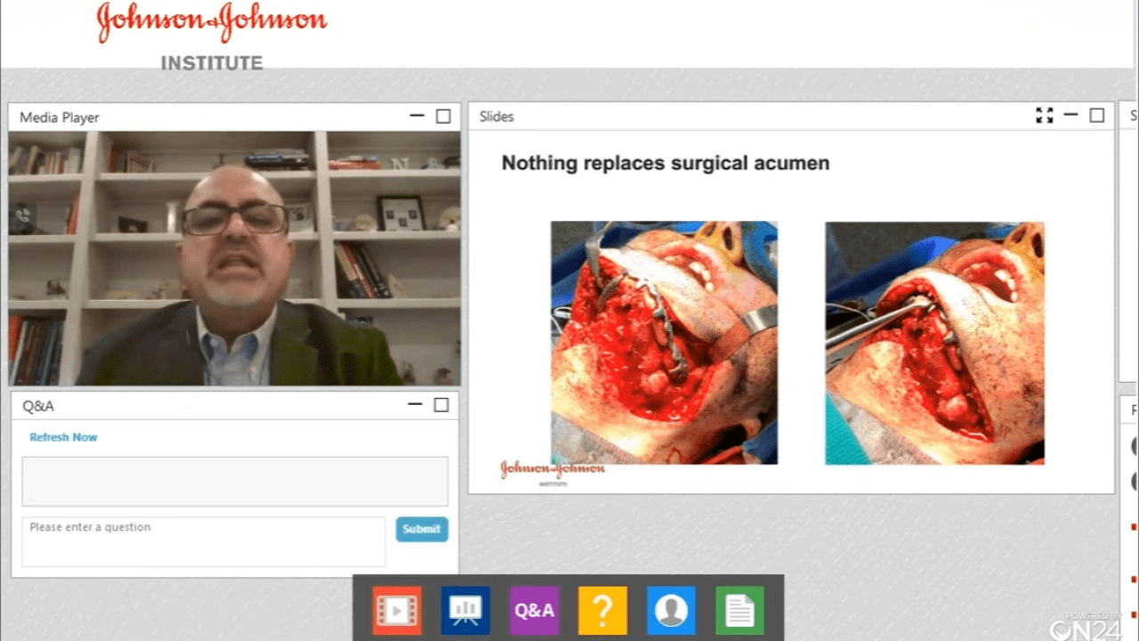 An image from the "Midface Trauma Fractures: Challenges in VSP & Additive Technologies with Nagi Demian, MD" video on the JnJInstitute.com website.