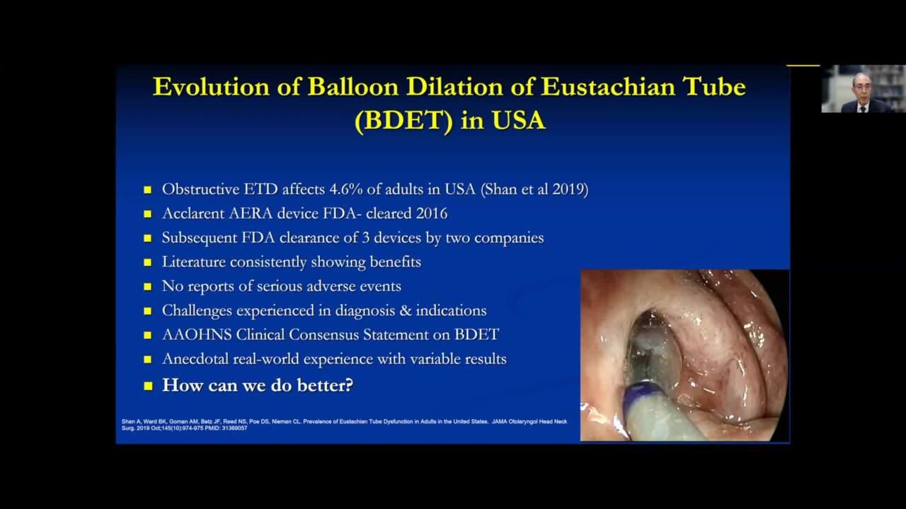 An Image From "The Evolution of Eustachian Tube Dilation, Dennis Poe MD"