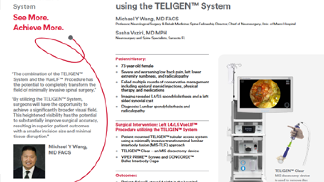 An Image From "Minimally Invasive VueLIF Procedure using the TELIGEN™ System - Michael Y. Wang, MD"