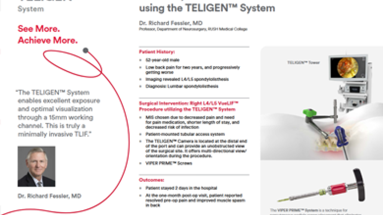 image from "Minimally Invasive VueLIF Procedure using the TELIGEN™ System - Richard Fessler, MD"