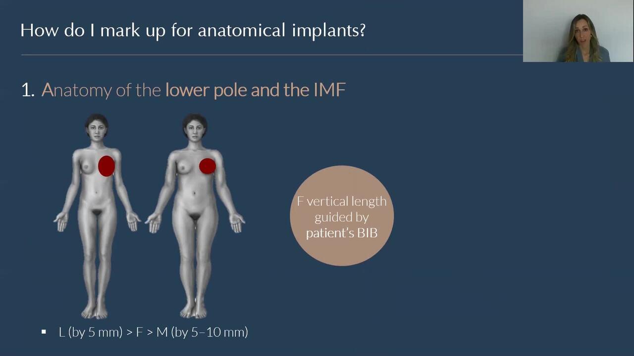 An Image From "How do you mark up for anatomical breast implants? "