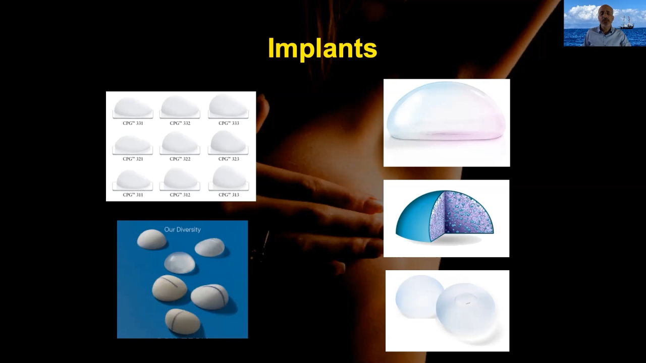 An Image From "What are the advantages of prepectoral vs. retropectoral (partial or complete) in Breast Reconstruction?"