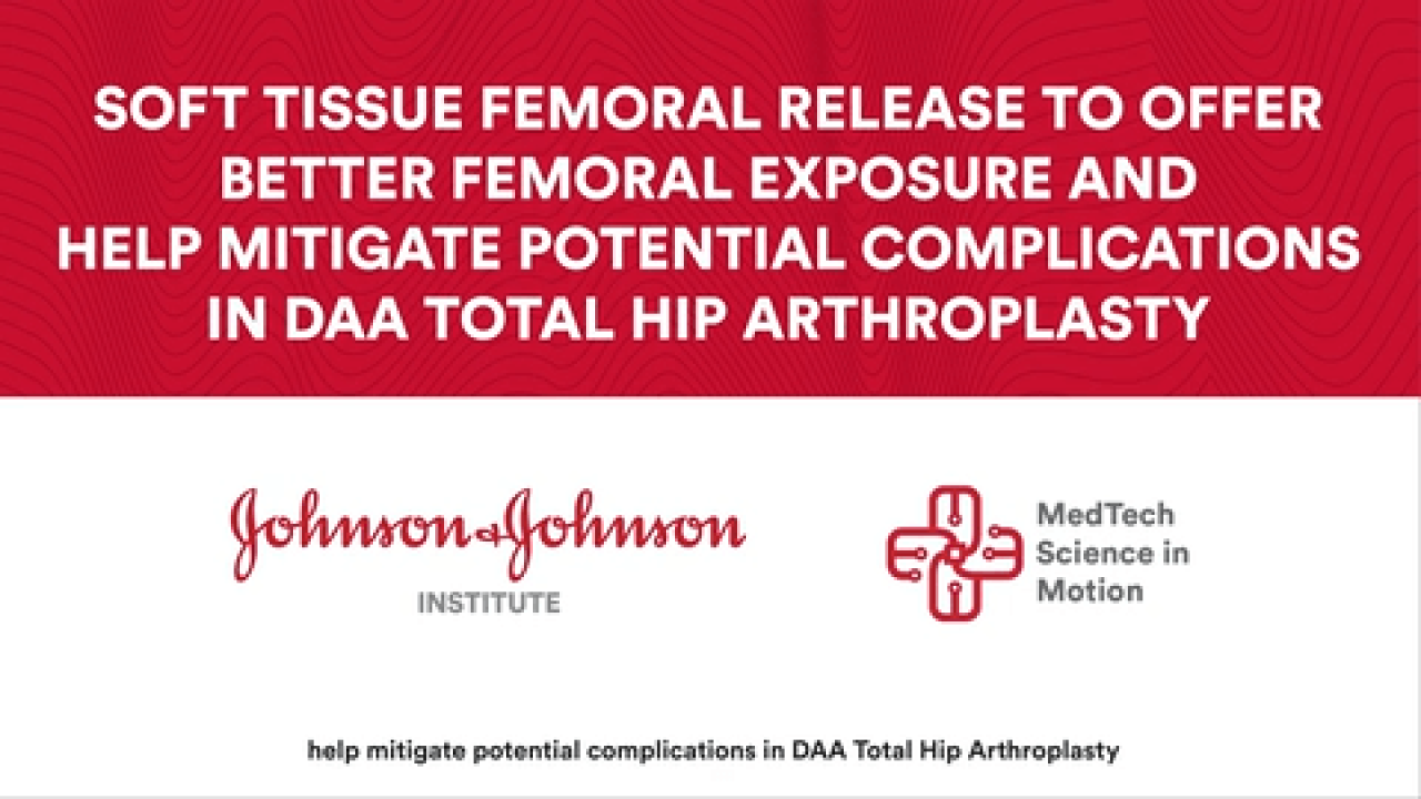Algorithmic soft tissue femoral release for better exposure in total hip arthroplasty performed through a DAA thumbnail