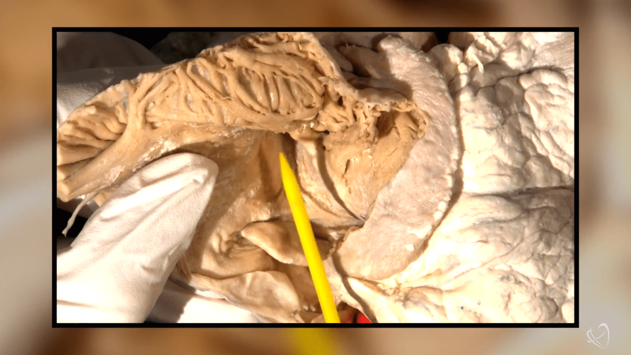 Atrial Anatomy for the Electrophysiologist Header Image