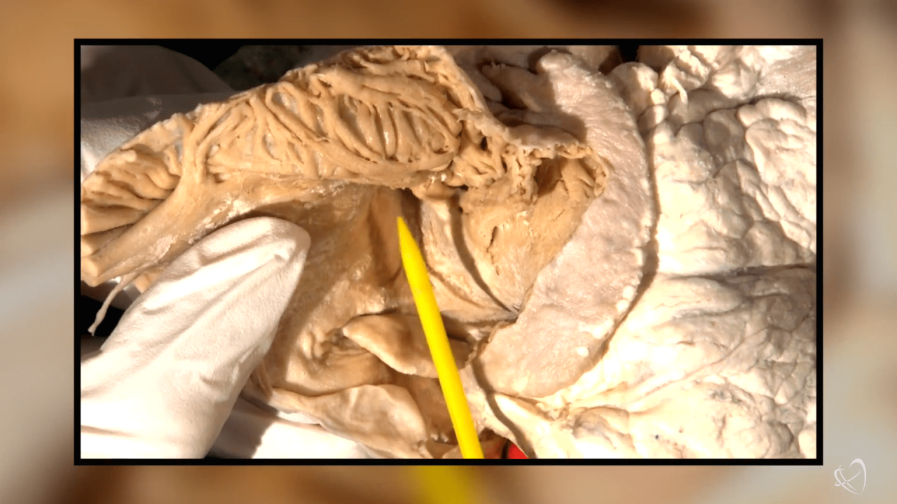 Atrial Anatomy for the Electrophysiologist Header Image
