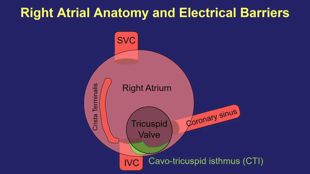 A header image of Atrial Flutter: Diagnosis & Ablation with Joshua Cooper, MD