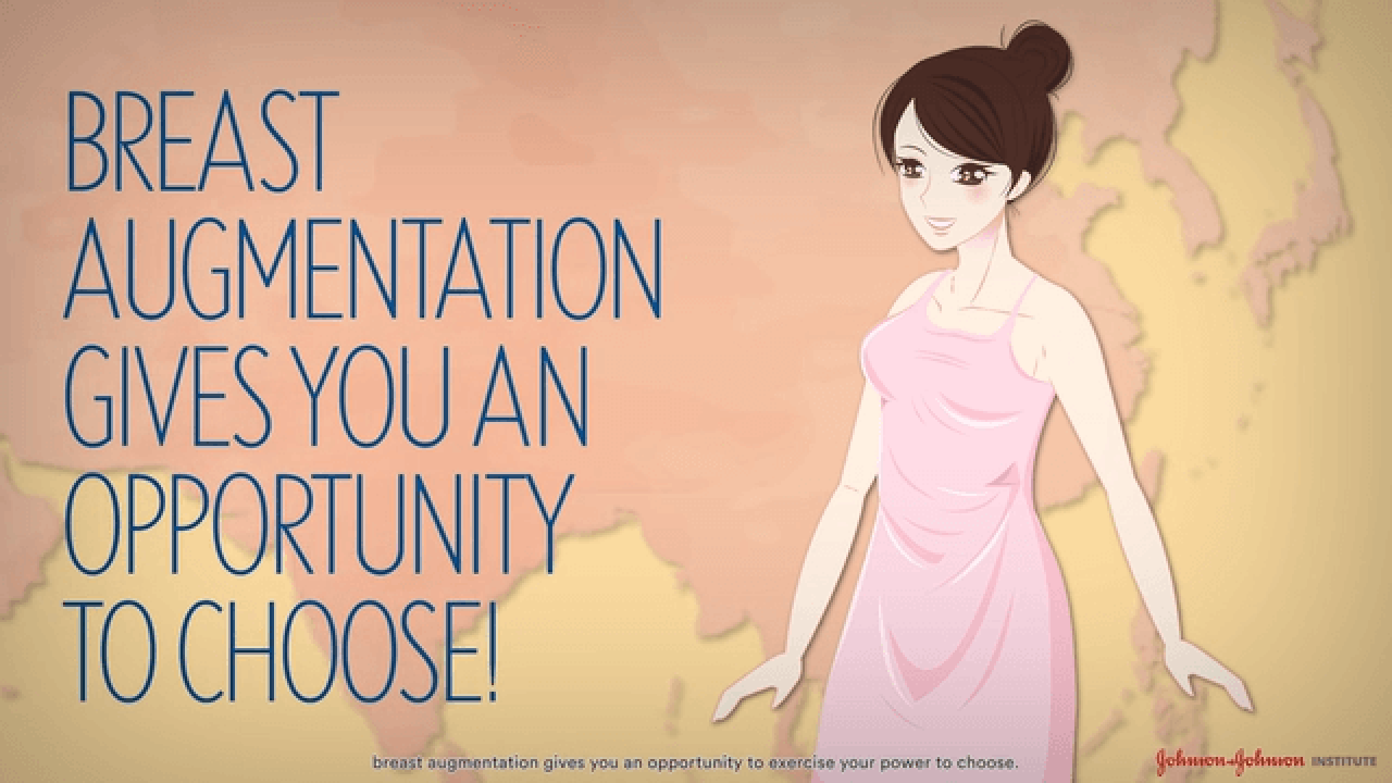 Breast Augmentation Things you want to know but are too shy to ask thumbnail
