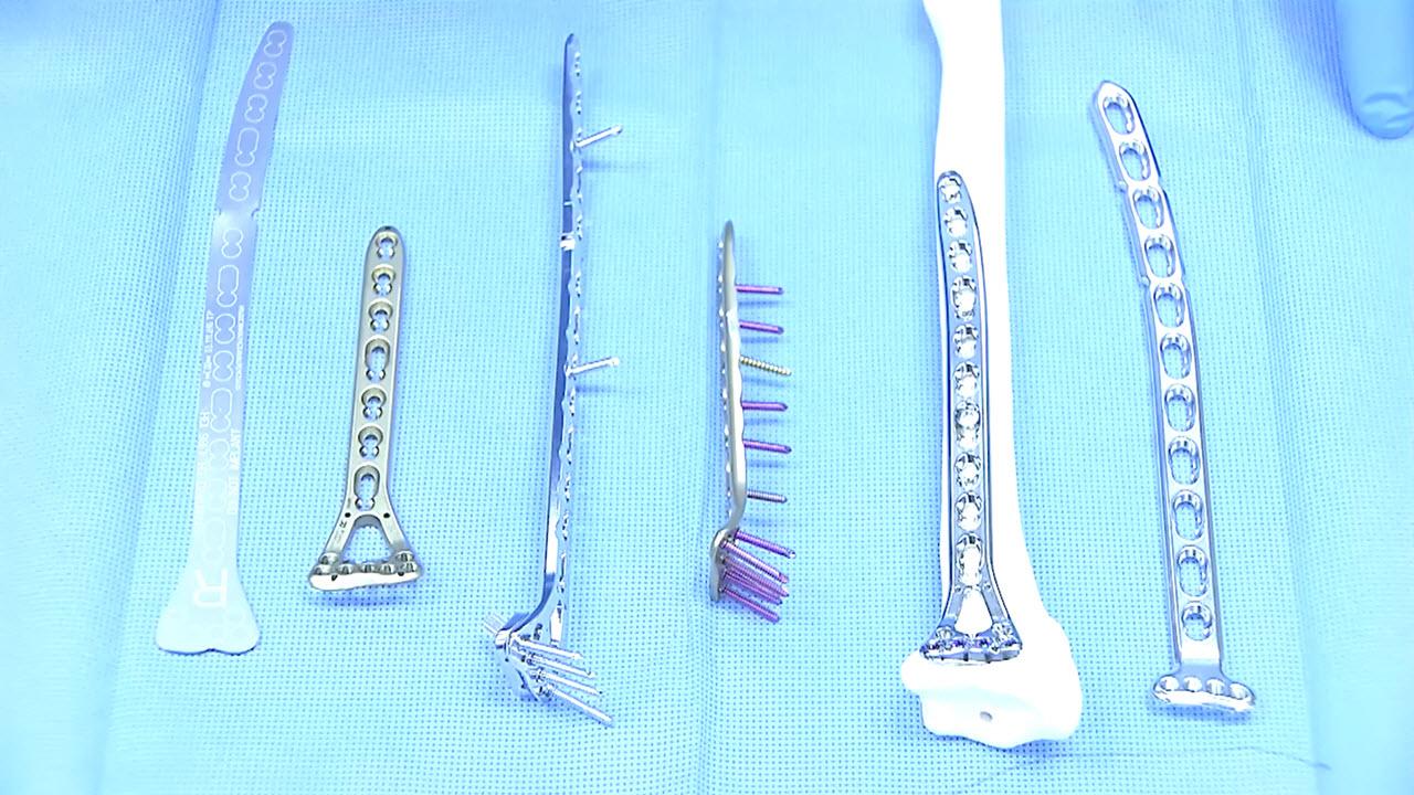 An image from the "VA LCP® Two-Column Volar Distal Radius Plate, Extra-Long Product Overview with Thomas Fischer, MD and Marc Richard, MD" video on the JnJInstitute.com website.