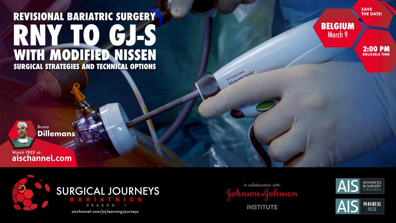 An Image From "RNY to GJ-S with Modified Nissen: Surgical Strategies and Technical Options"