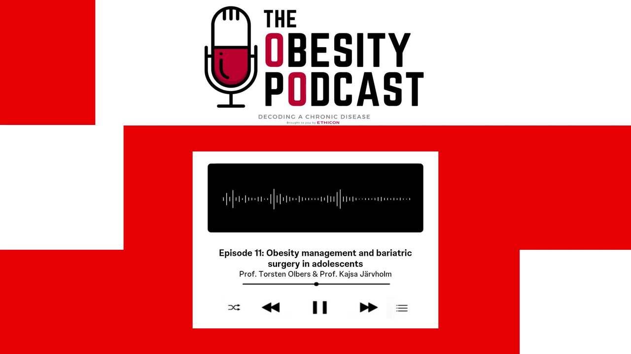 The Obesity Podcast - Episode 11: Obesity management and bariatric surgery in adolescents thumbnail