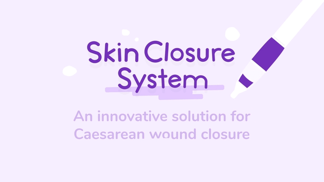 How To Care For Your Caesarean Wound With The Skin Closure System thumbnail