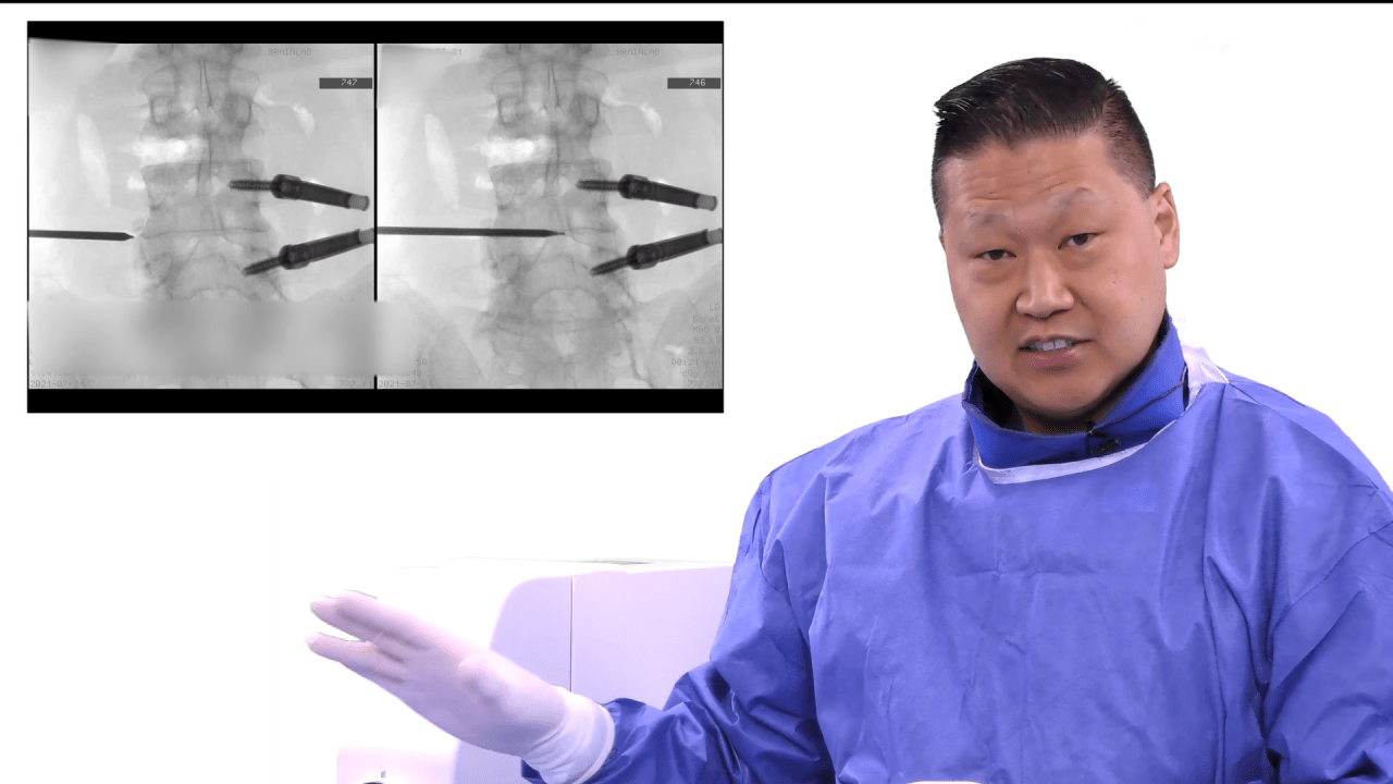 An image from the "TELIGEN™ System VueLIF-T™ Procedural Solution with Michael Wang, MD" playlist on the JnJInstitute.com website.
