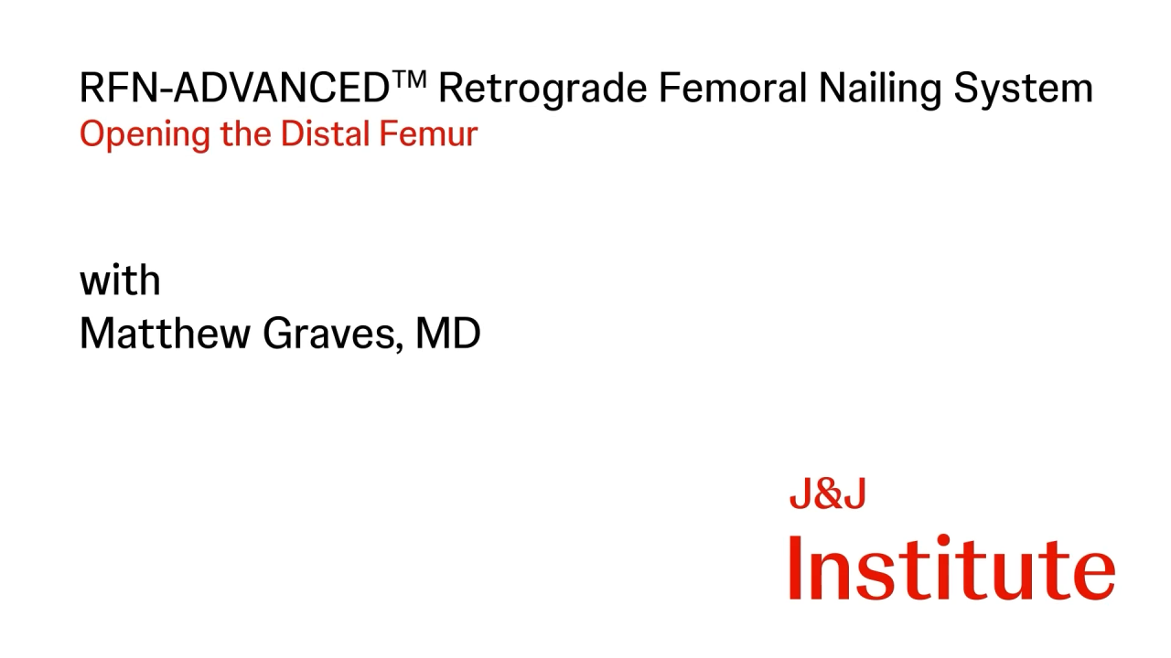 Thumbnail image from RFN-ADVANCED Retrograde Femoral Nailing System (RFNA) with Matthew Graves, MD