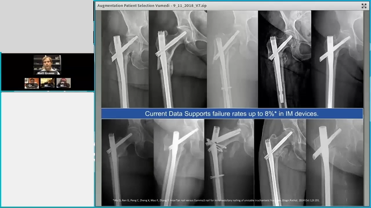 Augmenting Geriatric Fractures with Michael Gardner, MD; Matthew Graves, MD; Michael Leslie, DO; Greg Osgood, MD thumbnail