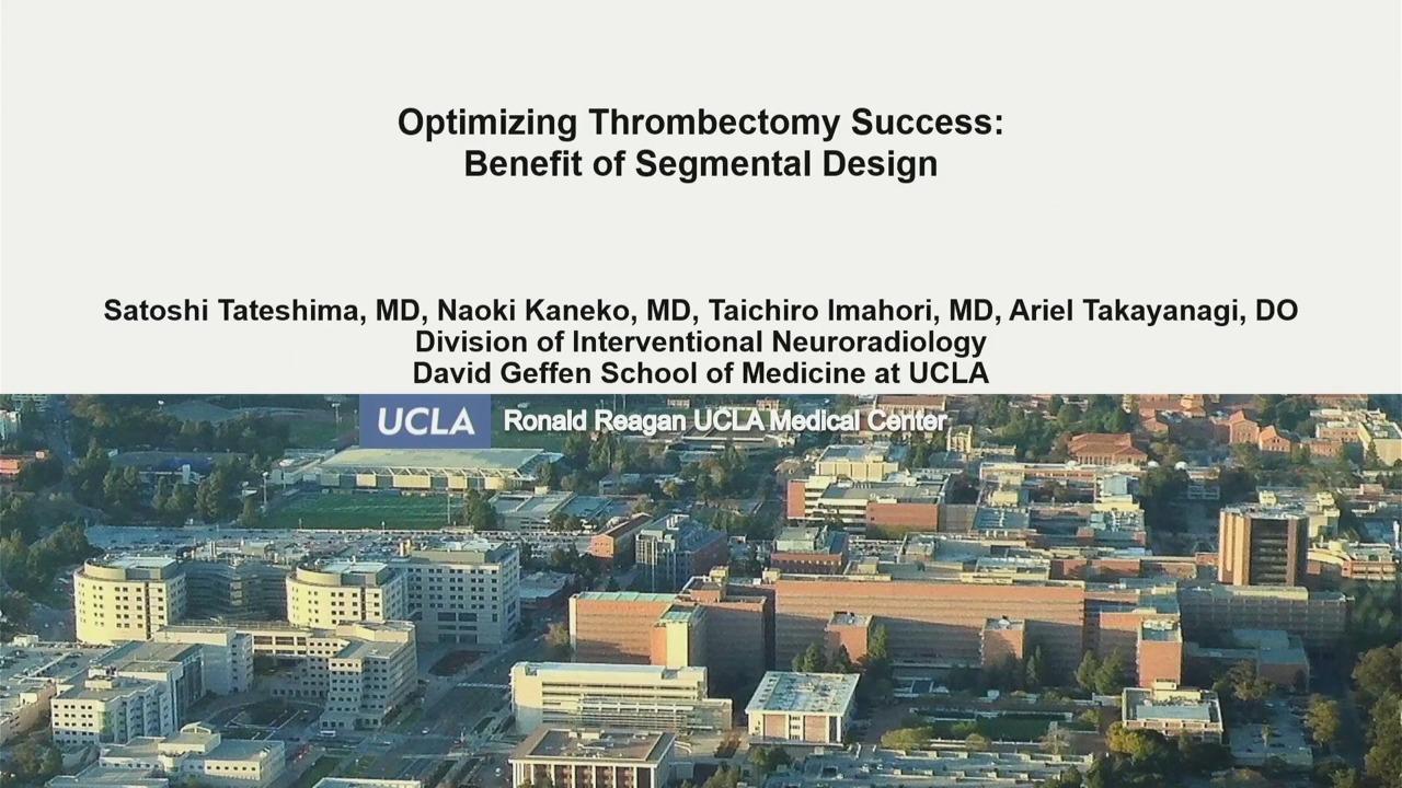 Optimizing Thrombectomy Success: Benefit of Segmental Design with Satoshi Tateshima, MD Header Image