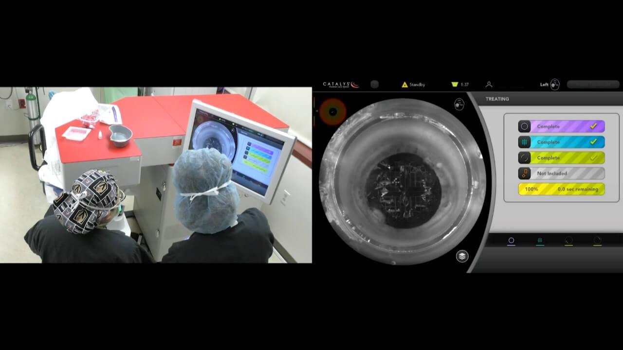 An image from the "CATALYS® Laser System: Capsulotomy & Lens Fragmentation Procedure with Dr. Eva Liang" video on the JnJInstitute.com website.