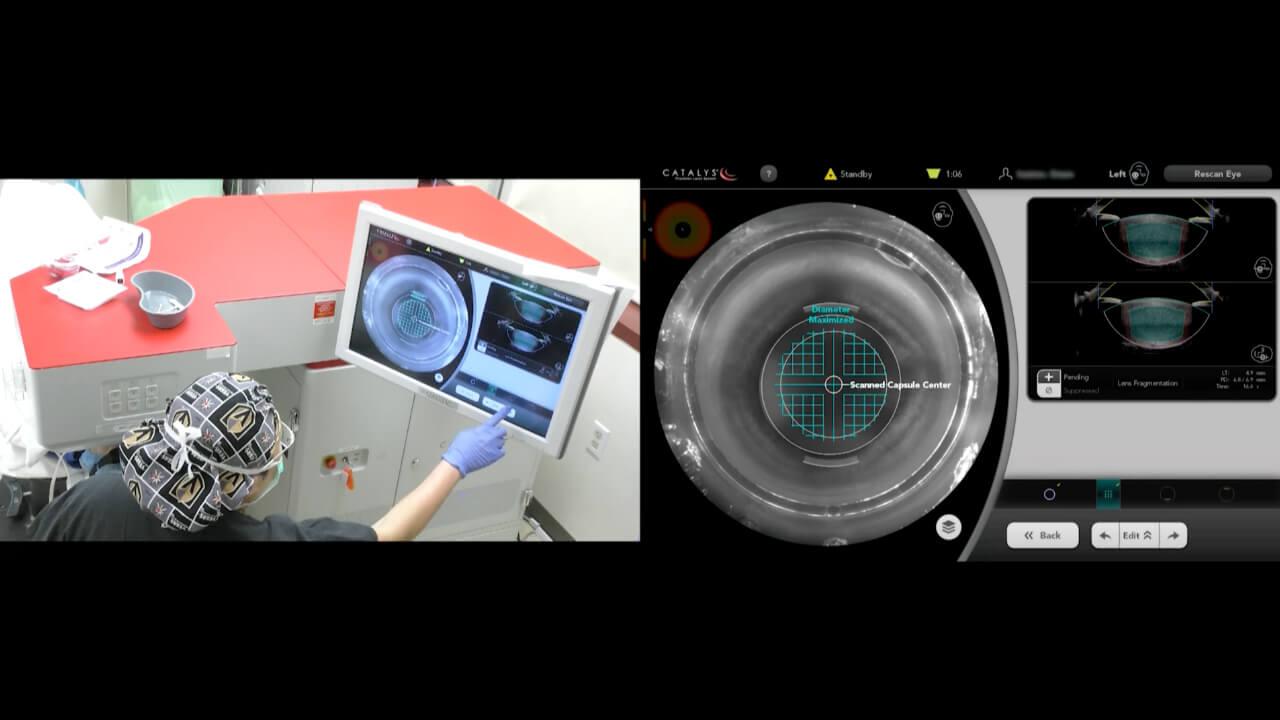 An image from the "CATALYS® Laser System Procedure from Start to Finish with Dr. Eva Liang" video on the JnJInstitute.com website.