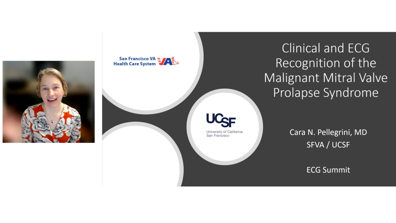 An Image From "Clinical and ECG Recognition of the Malignant Mitral Valve Syndrome with Cara Pellegrini, MD"