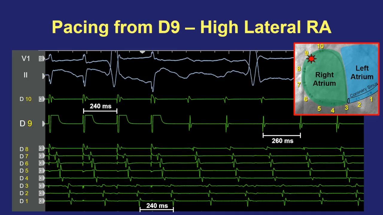 An image from the "Principles of Entrainment with Joshua Cooper, MD" playlist on the JnJInstitute.com website.