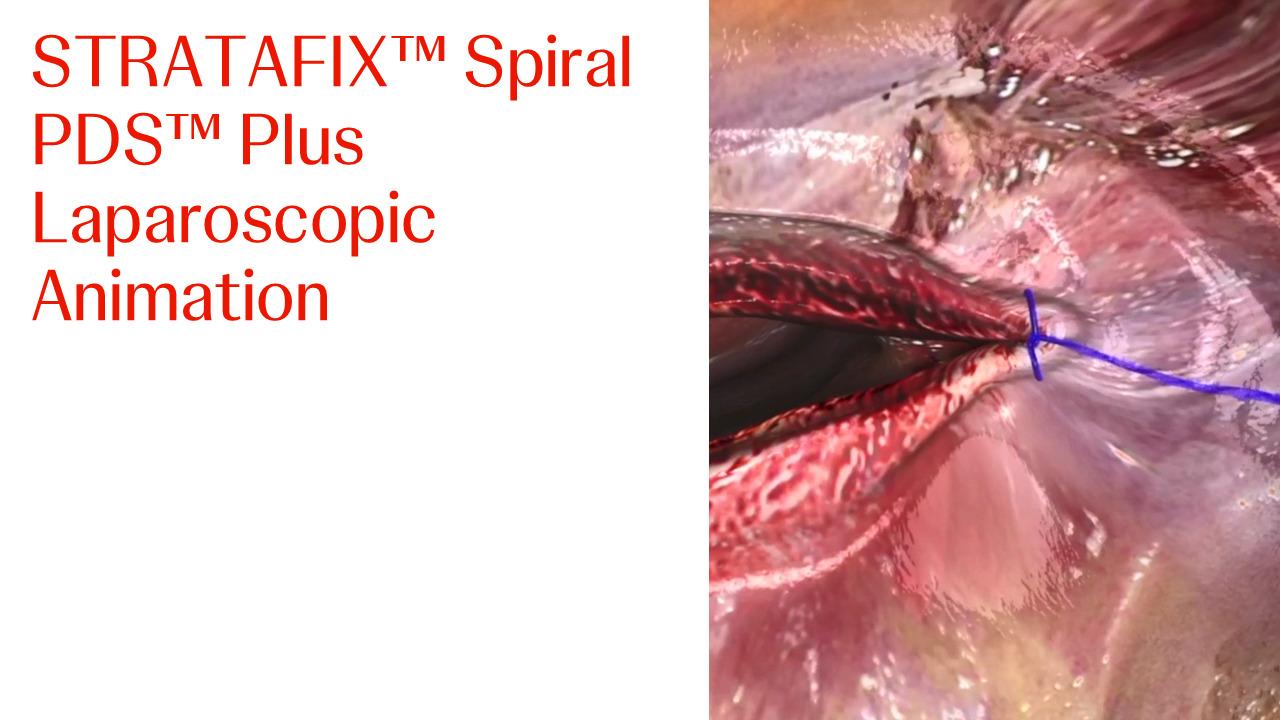 An image of the "STRATAFIX Spiral PDS Plus Laparoscopic Animation" video.