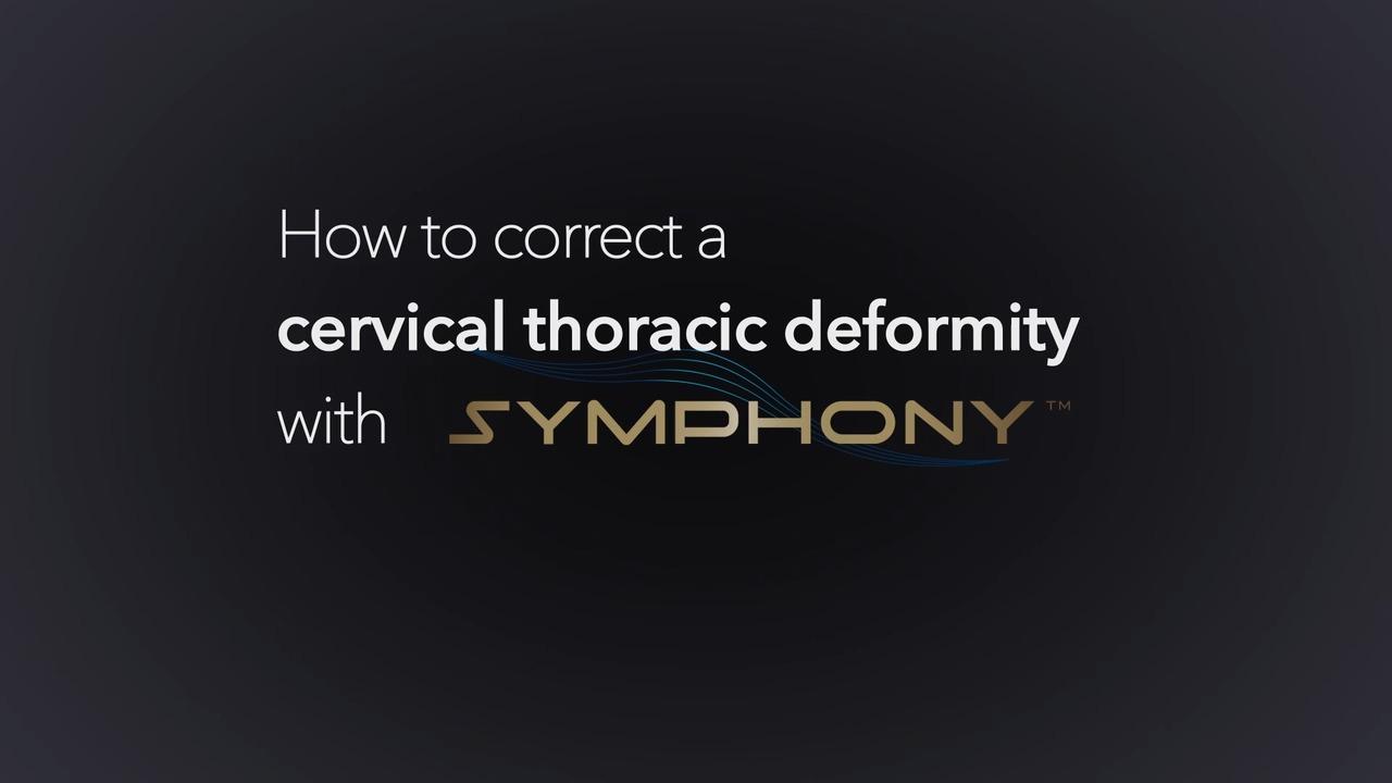 An image from the "Correcting a Cervico-Thoracic Deformity using the SYMPHONY™ OCT System with Dr. Christopher Ames & Dr. Joseph Osorio" playlist on the JnJInstitute.com playlist.