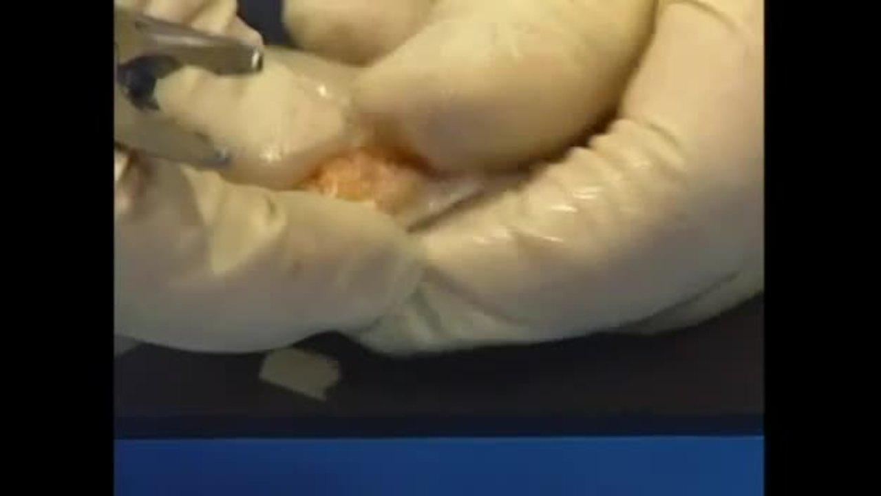 An Image From "BTB Graft Prep"