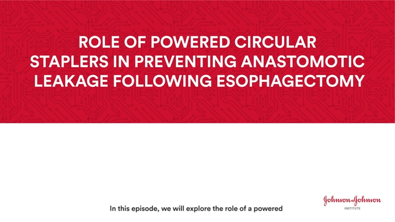 The role of powered circular staplers in preventing anastomotic leakage following esophagectomy thumbnail