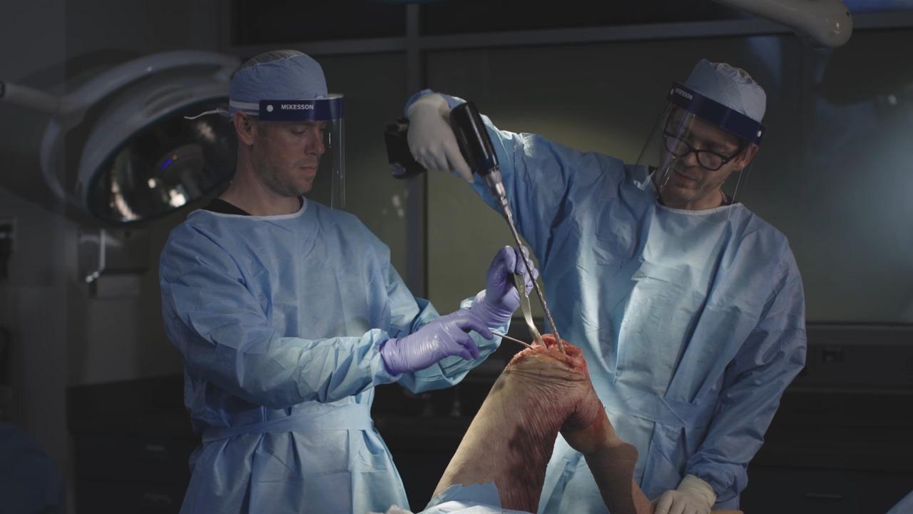 An Image From "ATTUNE Revision Knee System: Procedural Workflow with Cones - Timothy Alton, MD"