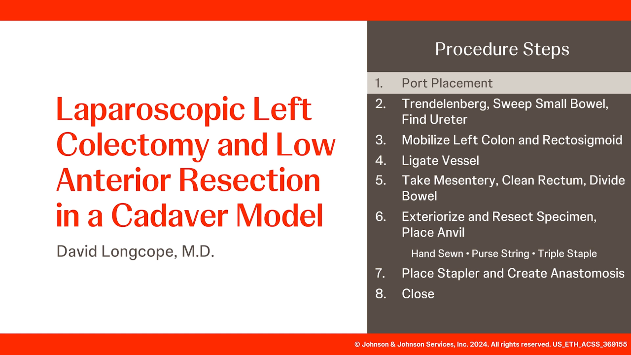 An Image From " Laparoscopic Left Colectomy and Low Anterior Resection in a Cadaver Model with David Longcope, MD"