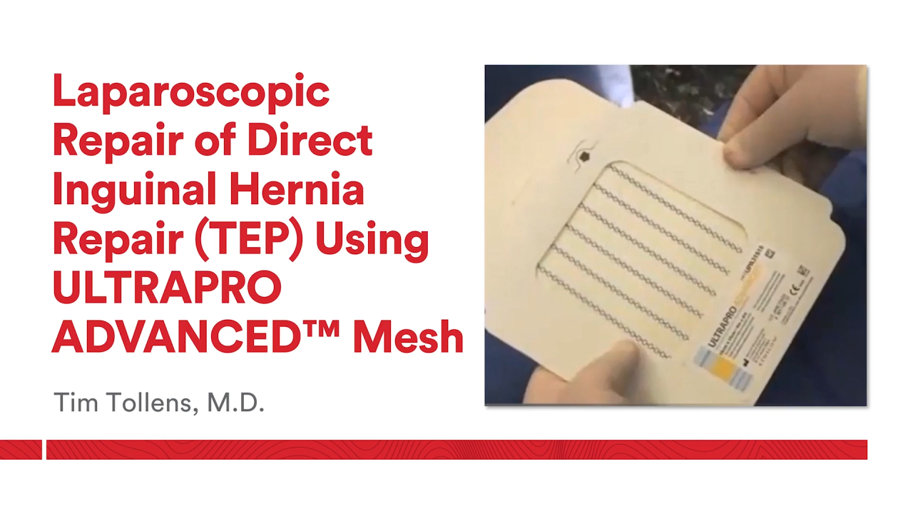 An image of the "Laparoscopic Repair of Direct Inguinal Hernia with TEP Approach - Tim Tollens, MD" video.