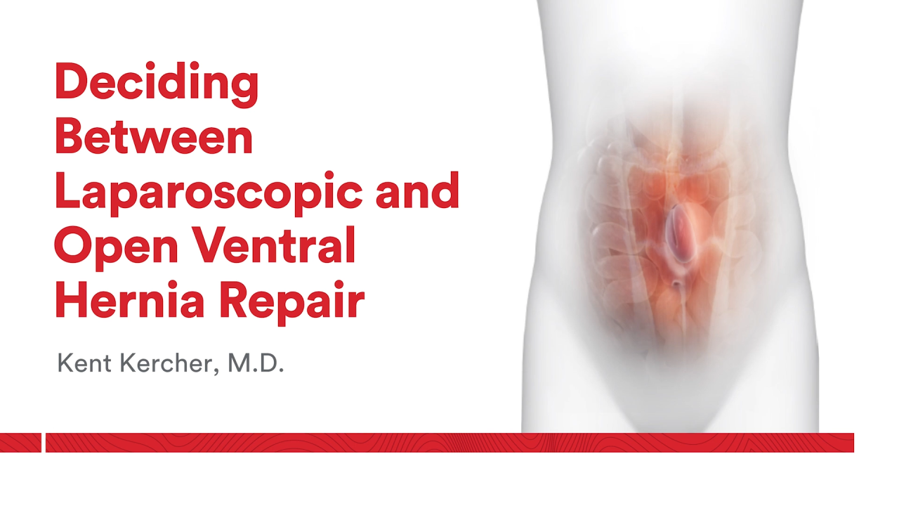 An Image From "Deciding Between a Laparoscopic and Open Ventral Hernia Repair with Kent Kercher, MD"