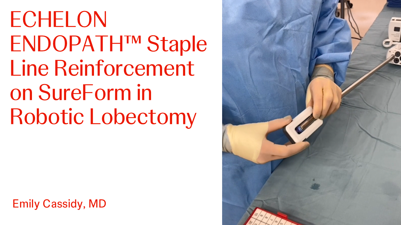An Image From "ECHELON ENDOPATH™ Staple Line Reinforcement on SureForm in Robotic Lobectomy with Emily Cassidy, MD"