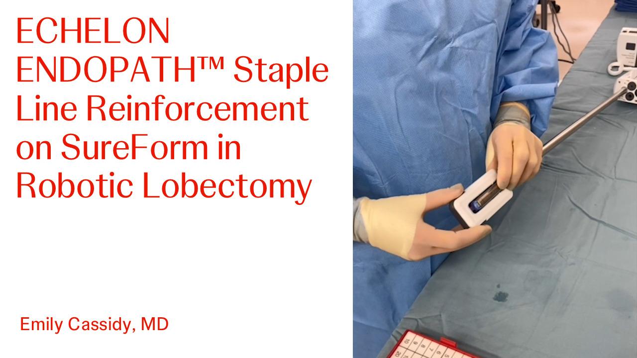 An Image From "One Anastomosis Gastric Bypass (OAGB) with James Dasher, MD and Thomas Walsh, MD"