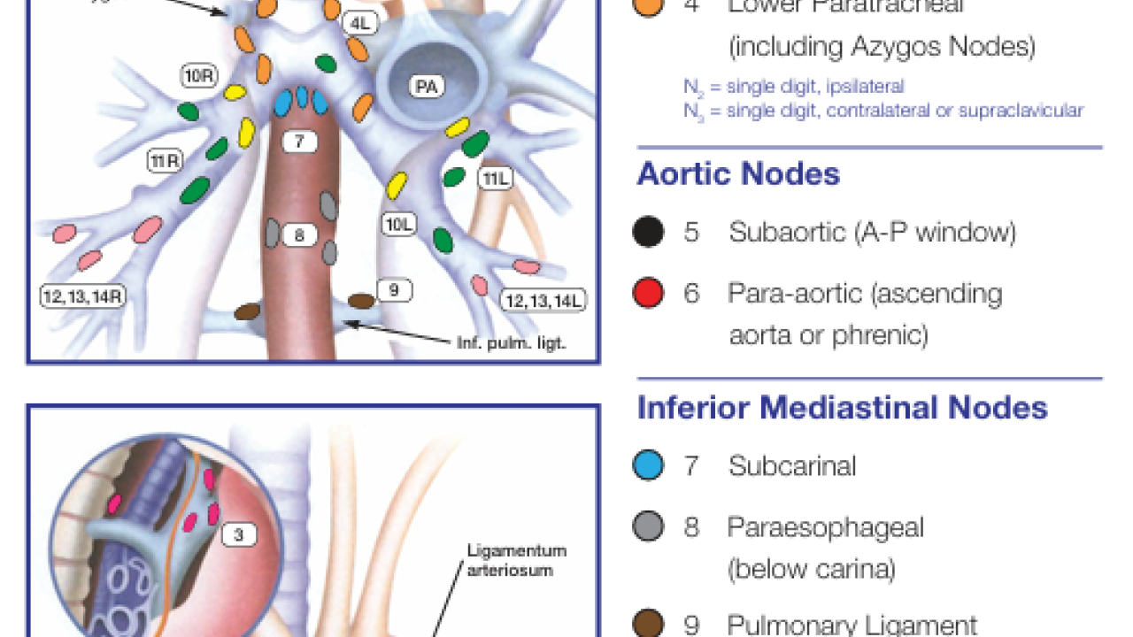 Regional Lymph Node Classification for Lung Cancer Staging