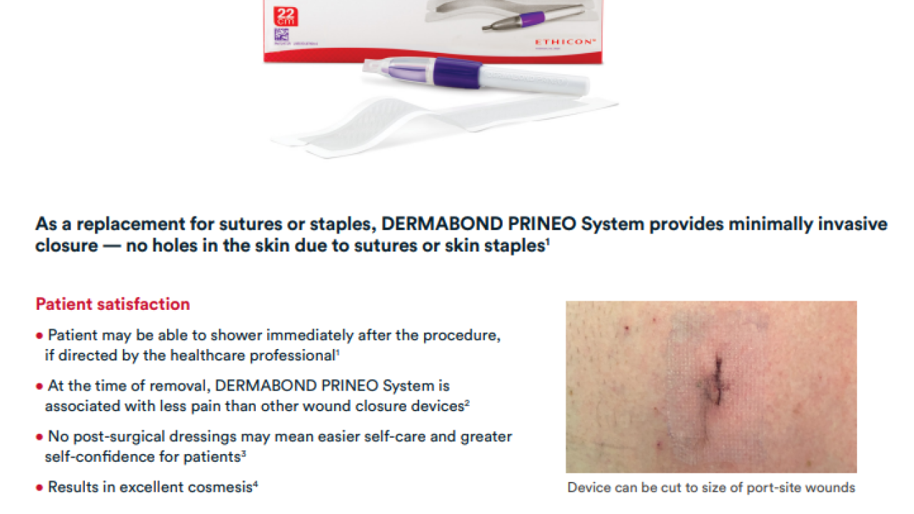 An Image From "DERMABOND™ PRINEO™ Port-Site Closure How-To Brochure"
