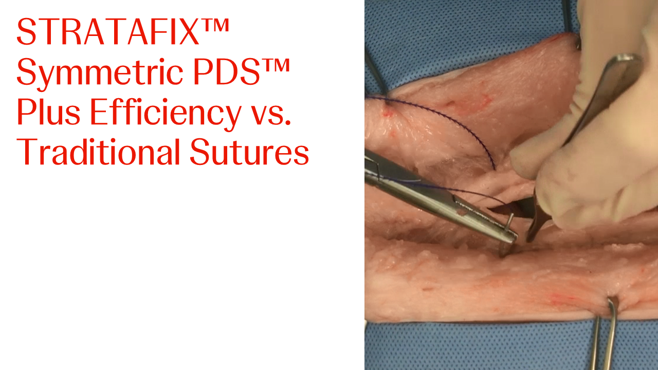 An image from the "STRATAFIX™ Symmetric Efficiency vs. Traditional Suture" video on JnJInstitute.com