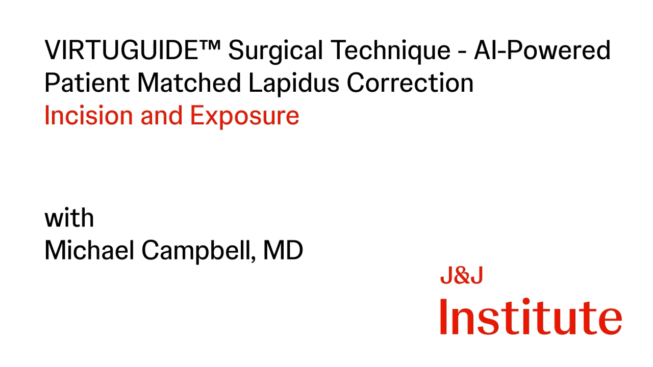 Thumbnail image for VIRTUGUIDE Procedural Workflow for Lapidus Correction with Michael Campbell, MD