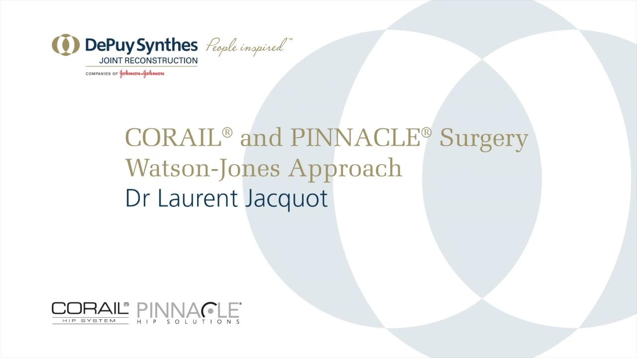 An image from the "Watson-Jones Surgical Approach with Laurent Jacquot, MD" playlist on the JnJInstitute.com website.
