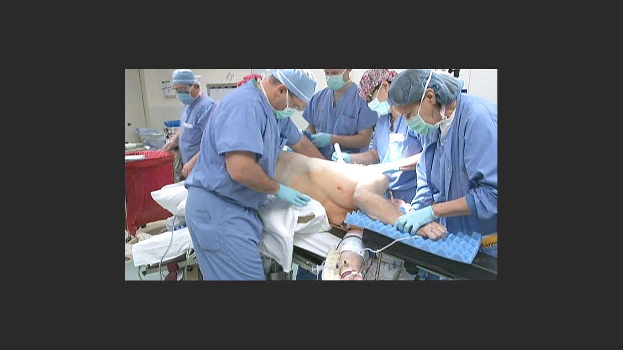 An image of the "VATS Lobectomy Patient Positioning with Traves D. Crabtree, MD" video.