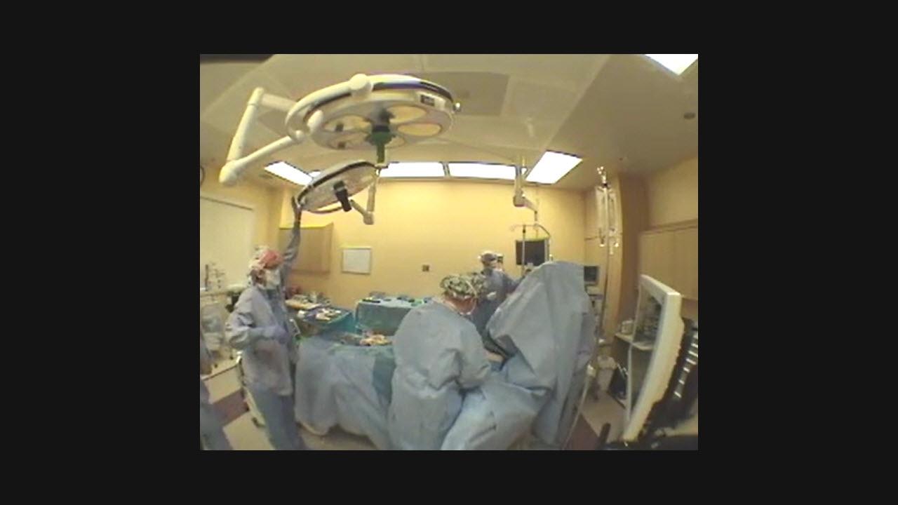 An image of the "TeleMENTORing Tuberous Breast with MemoryShape with Dennis Hammond, MD" video.