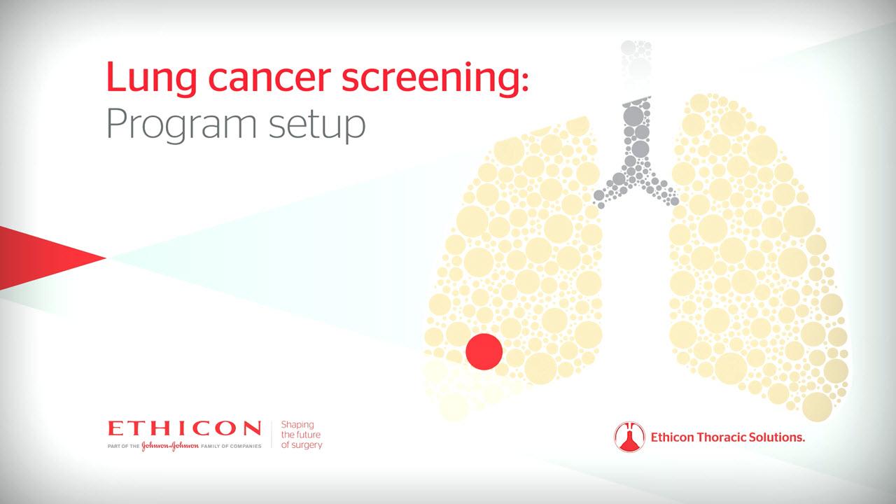 How to Set Up a Lung Cancer Screening Center Johnson
