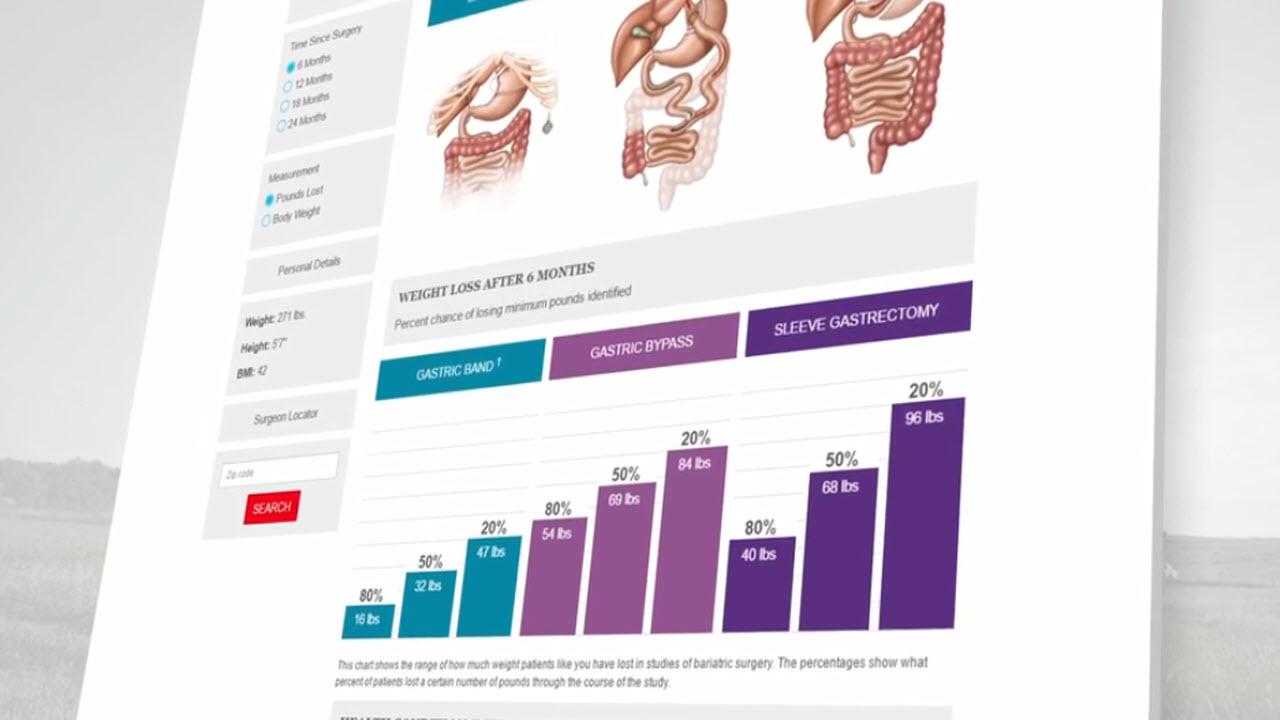 Image from the "Health Partner for Weight Loss Surgery Website Overview" video on the JnJInstitute.com website