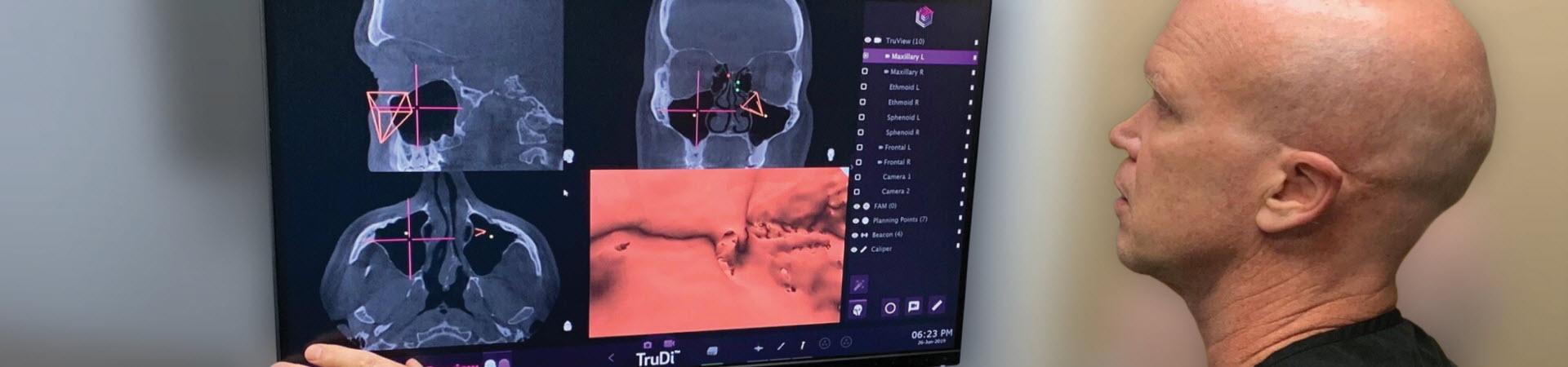 Otolaryngology Specialty Landing Page Hero Image - Johnson & Johnson Institute