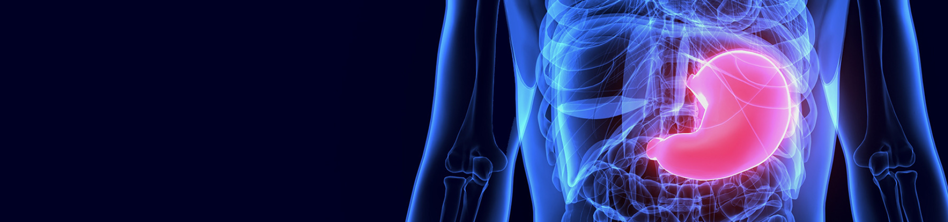 Bariatric 